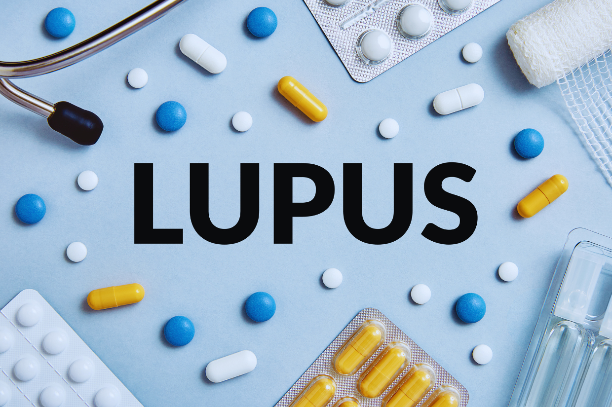 Treatment of Lupus: Effective Strategies for Managing Lupus Symptoms