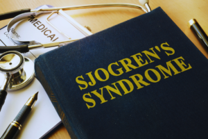 Understanding Sjogren's Syndrome Cause and Treatment