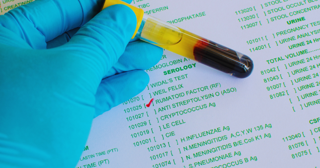 rheumatoid factor