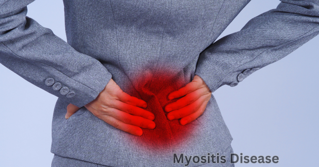 Myositis Disease