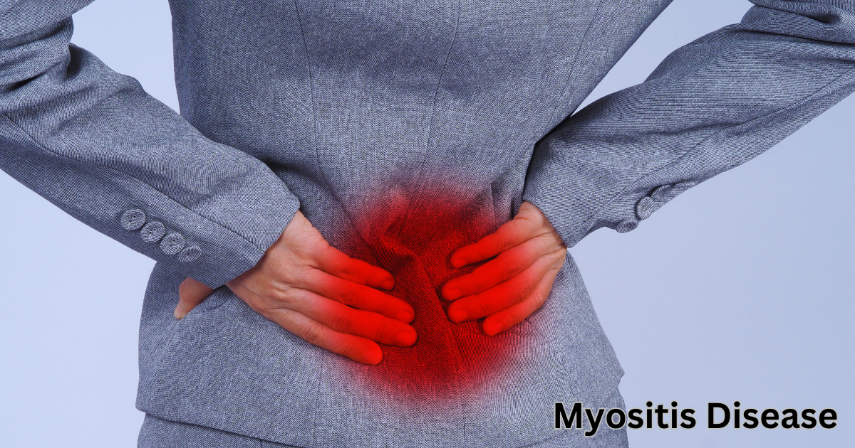 Myositis Disease