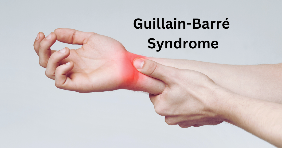 Guillain-Barré Syndrome (GBS), its symptoms, causes, and immune system impact in autoimmune diseases.