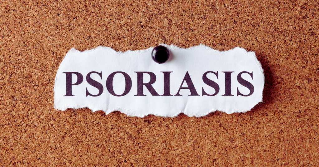 Psoriatic arthritis symptoms and treatment options for joint inflammation and skin issues.