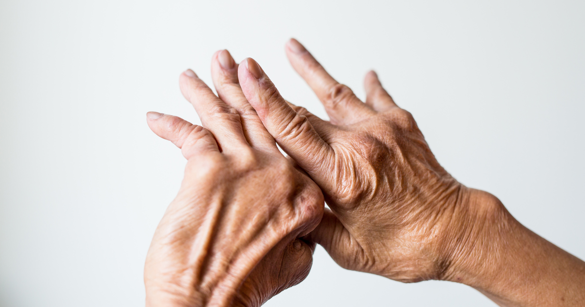 inflammatory arthritis