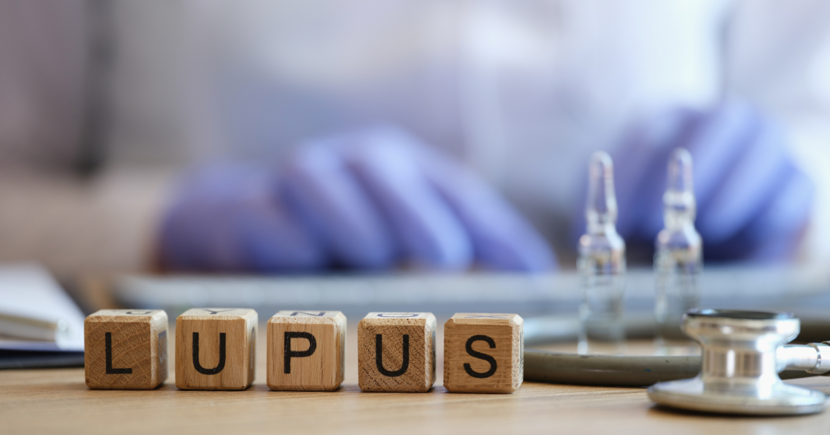 Immunotherapy in Lupus Management