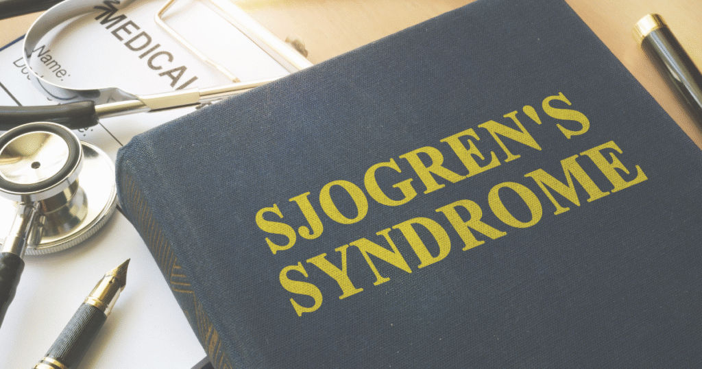 Sjogren’s Syndrome