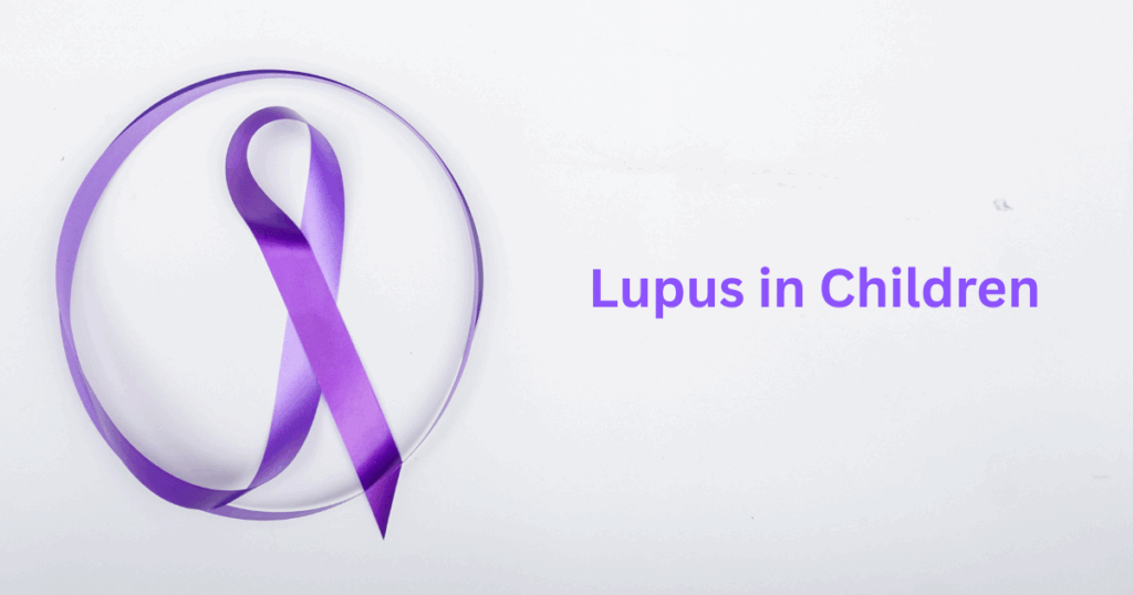 Lupus in Children