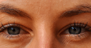 early signs of sjogren's syndrome