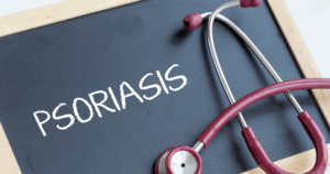 Psoriatic Arthritis
