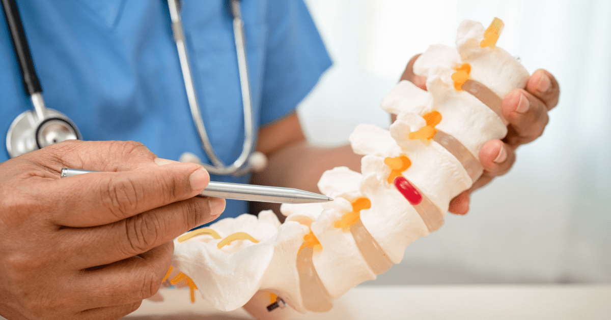 Ankylosing Spondylitis