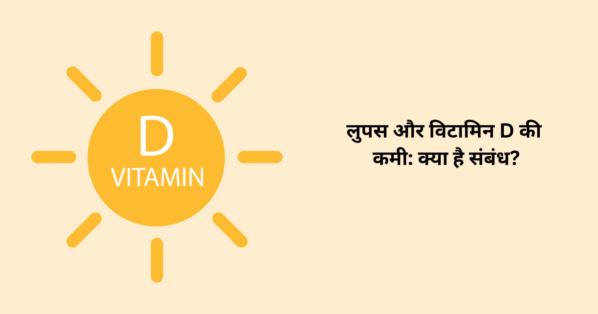 लुपस और विटामिन D