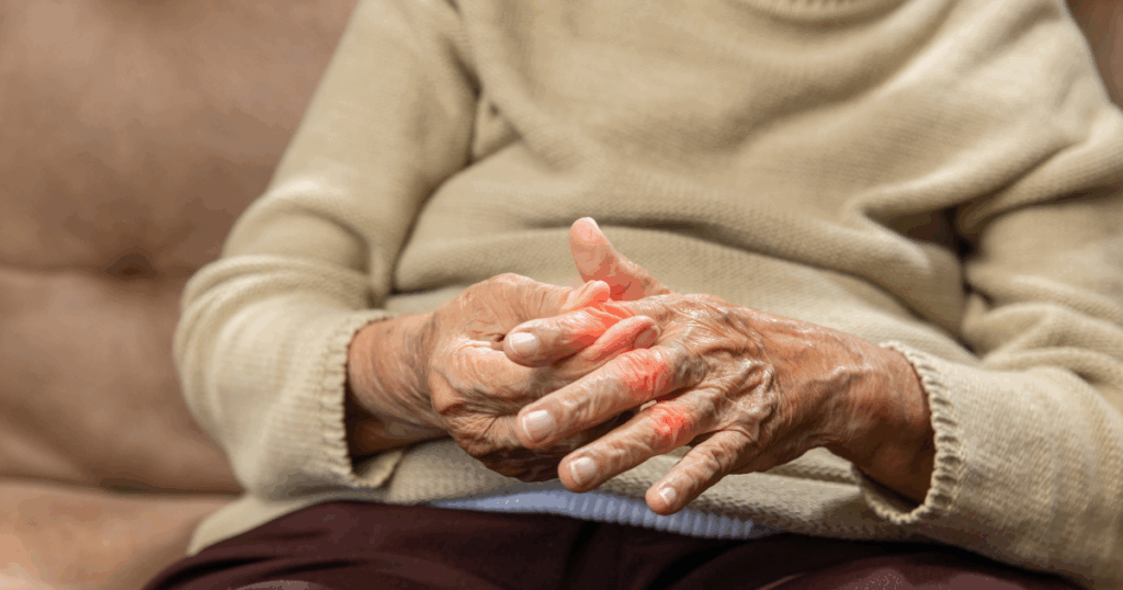 बुज़ुर्गों में जोड़ दर्द: क्या हमेशा ऑस्टियोआर्थराइटिस?