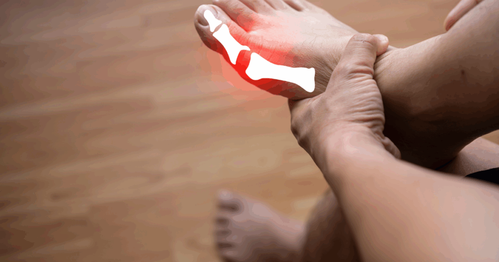 Uric Acid and Kidney Health