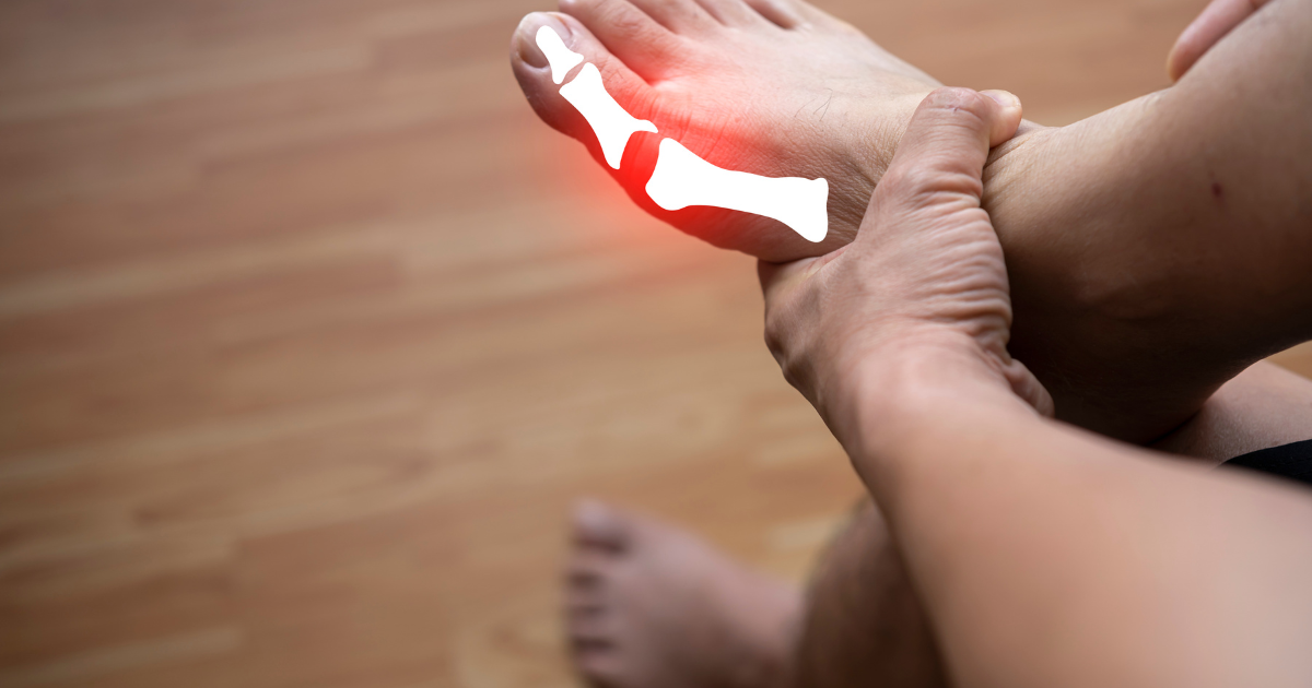 Uric Acid and Kidney Health