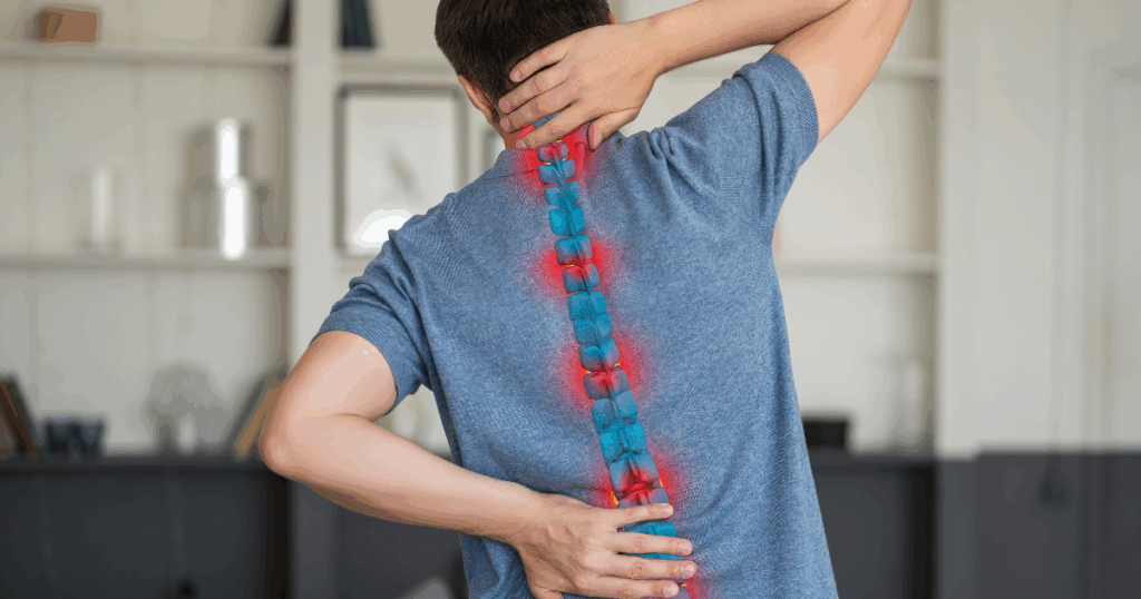 Spinal Fusion in Ankylosing Spondylitis