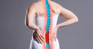 Ankylosing Spondylitis vs Sciatica