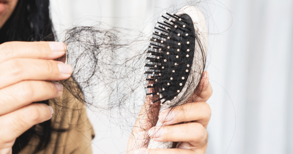 Hair Loss in Lupus