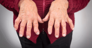 Psoriatic Arthritis और नाखूनों में बदलाव: आपके नाखून क्या संकेत दे रहे हैं?