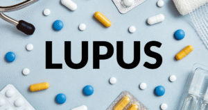 Belimumab vs Anifrolumab for Lupus: Key Differences