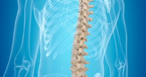 Can Early Treatment Prevent Spinal Fusion in Ankylosing Spondylitis