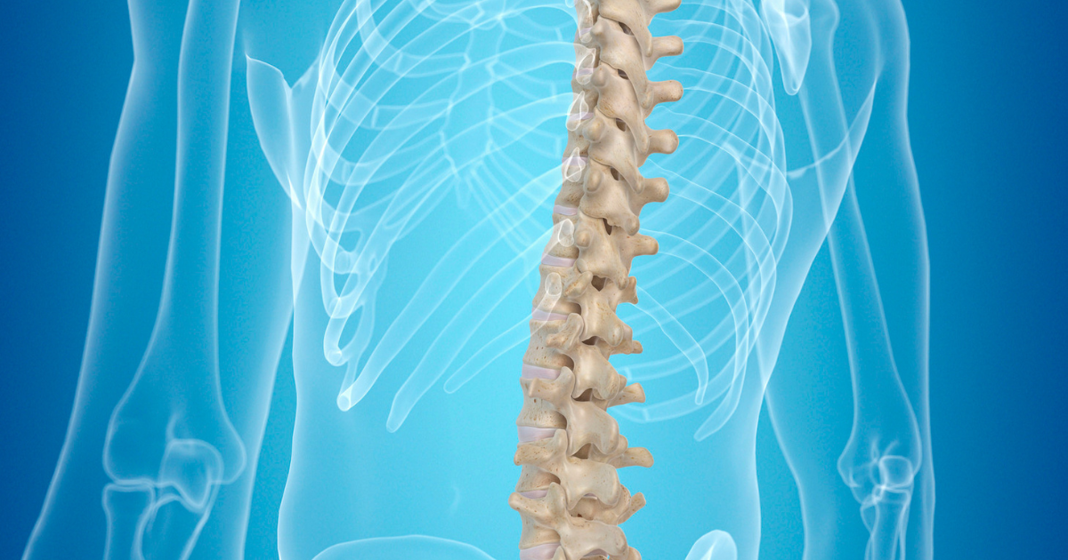 Can Early Treatment Prevent Spinal Fusion in Ankylosing Spondylitis