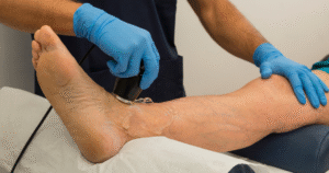 Can Ultrasound Detect Gout Before Joint Damage Begins?